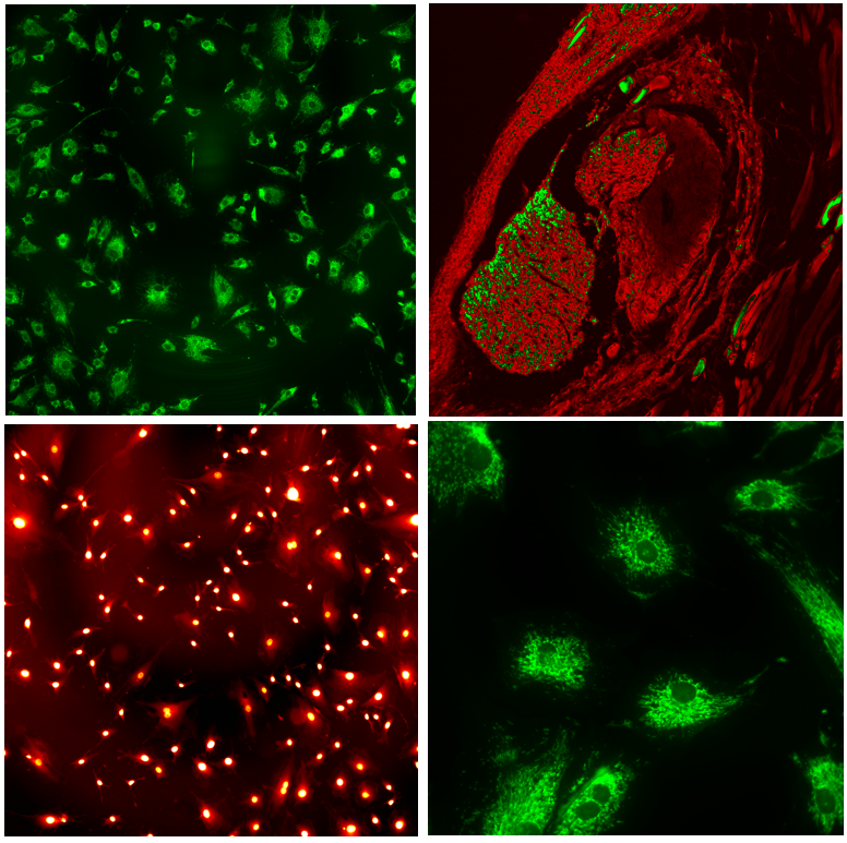 巅峰国际官网-钻营健全,你我一路成长